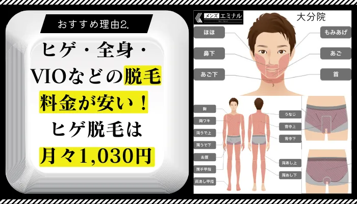 メンズエミナル大分おすすめ理由2