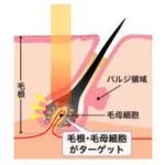 熱破壊式
