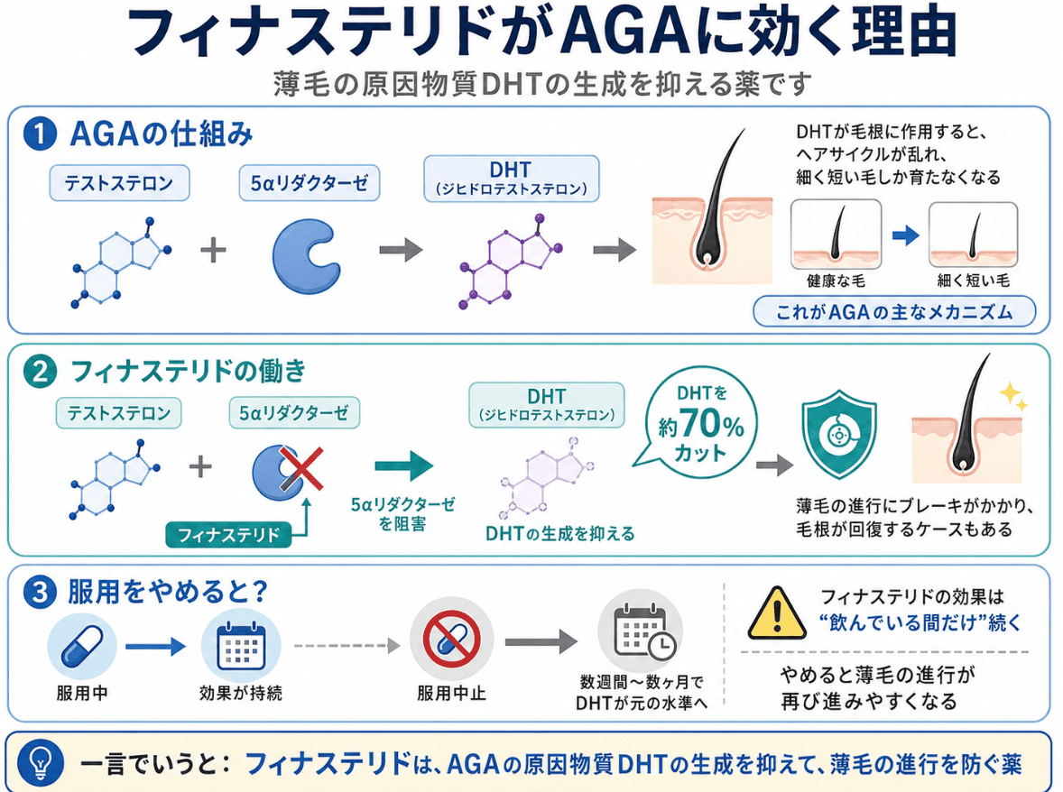 フィナステリドの効果とは？やめるとその効果はどうなるか