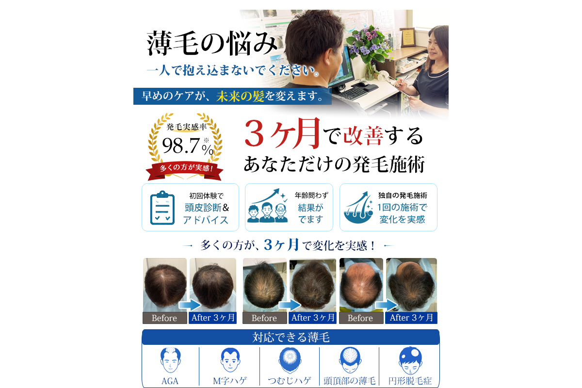 鹿児島中央店 スーパースカルプ発毛センター|発毛技能士に薄毛対策を相談できる発毛サロンの公式サイト
