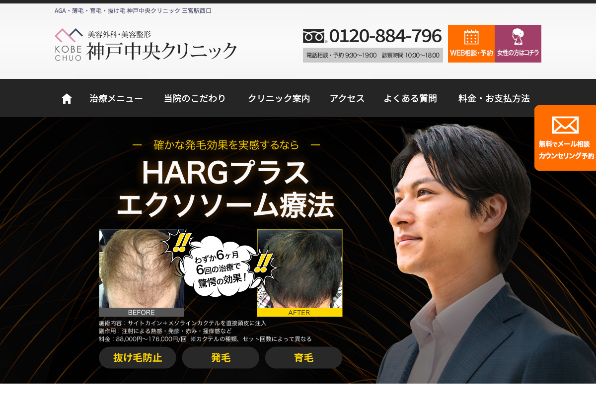 神戸院 神戸中央クリニック|内服薬・外用薬からHARGプラス療法まで相談できる薄毛治療クリニックの公式サイト