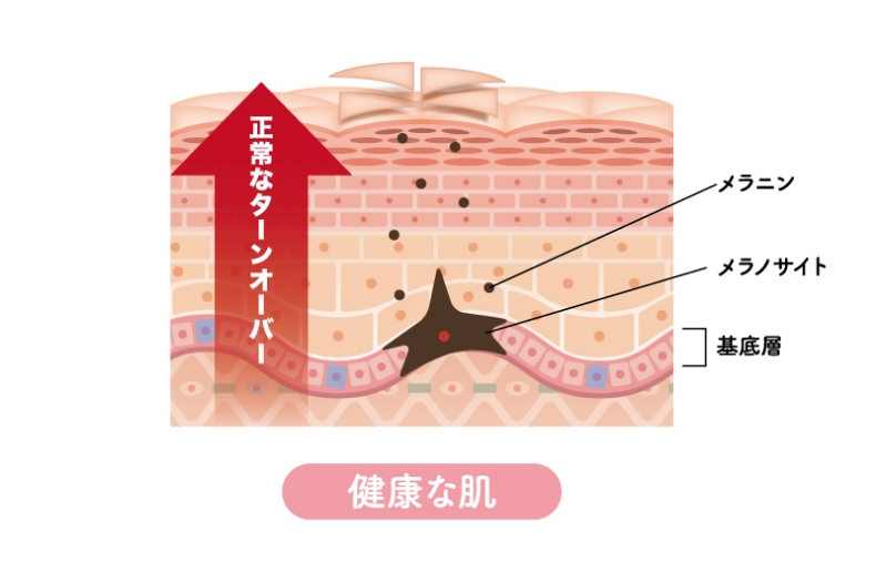 しみができるメカニズム