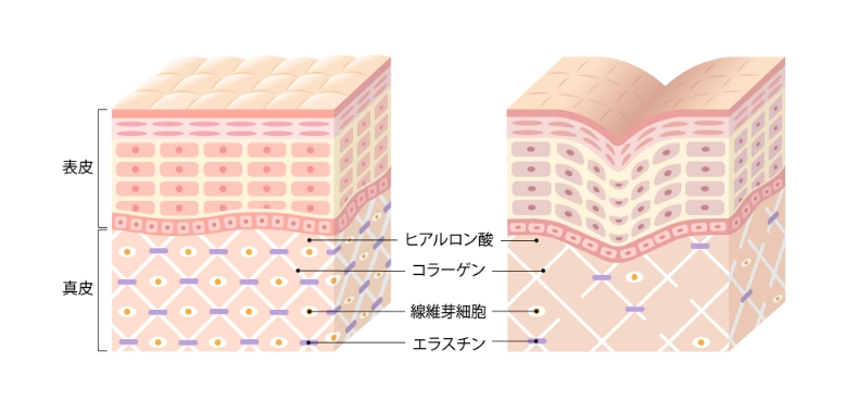 しわ・たるみのメカニズム