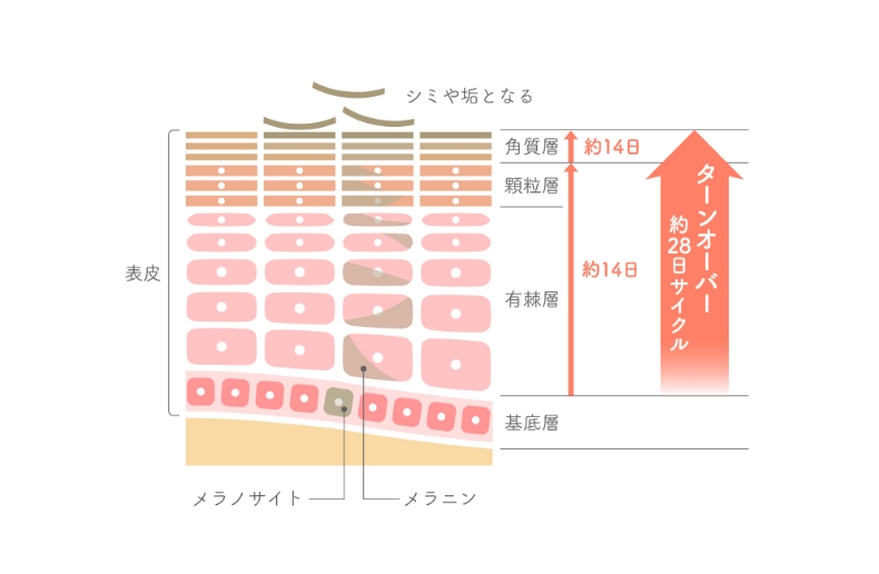 しみができるメカニズム